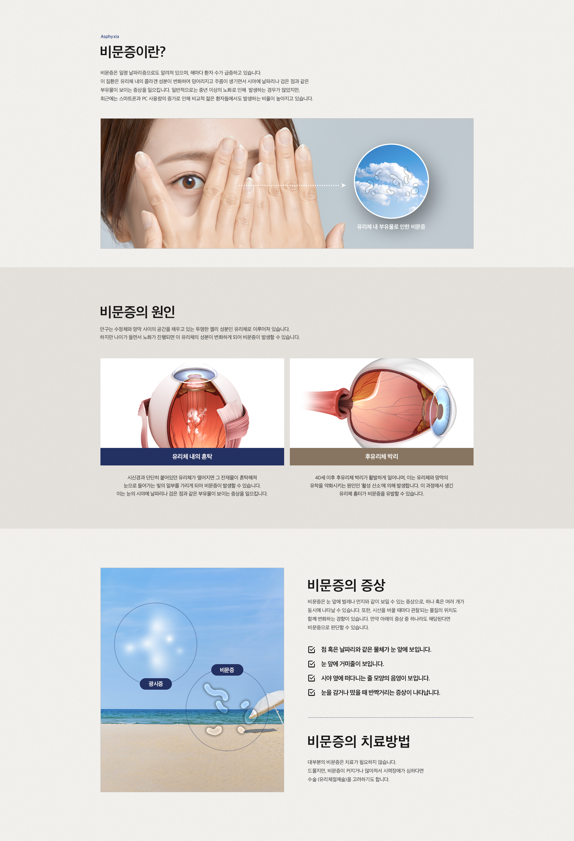 비문증